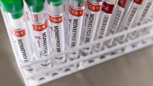 Daha bir ölkədə meymunçiçəyi AŞKARLANDI