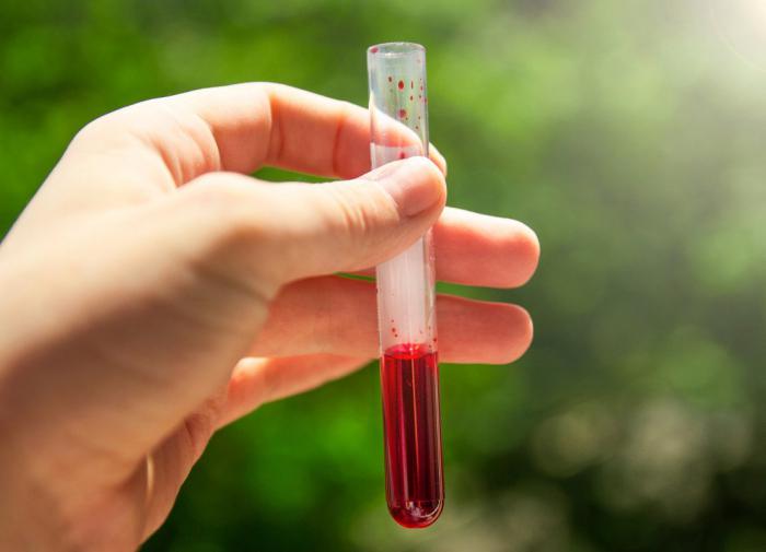 Romanenko: profilaktika məqsədilə 30 ildən sonra hər il ümumi qan analizi vermək tövsiyə olunur