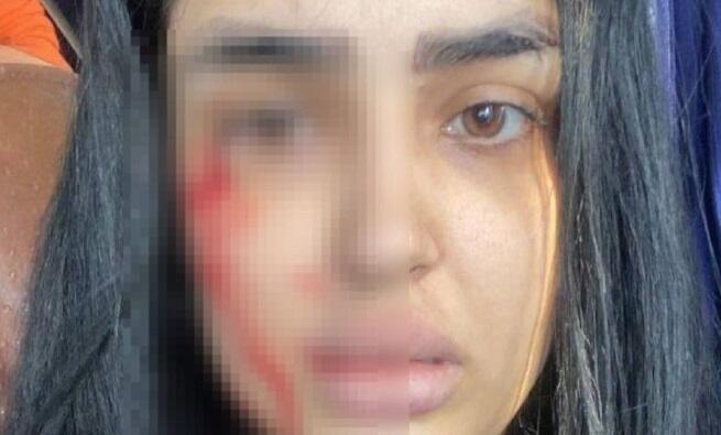 Qətlə yetirilən azərbaycanlı şairənin bacısı da güllələndi