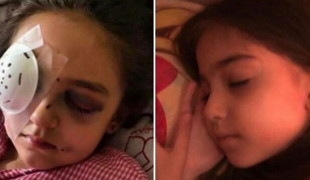 SEPAH 6 yaşlı uşağı kor elədi